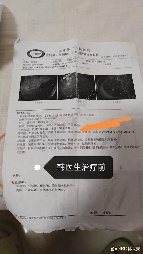 贵州新增本土确诊病例，2例/1例情况汇总